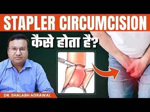 Circumcision कराना है? Stapler Circumcision Technique vs Traditional –कितना खर्च आता है?