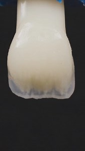 Composite Layering technique ✔️ #dentalschool | Dental Art