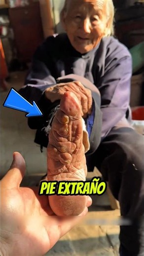 ¡Los pies más EXTRAÑOS del mundo! 🦶