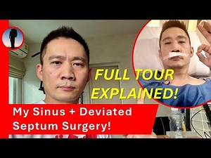 My Sinus and Deviated Septum Surgery Explained - FULL TOUR!