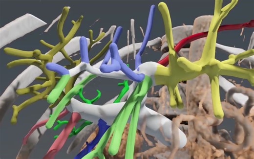 MeVisLab 渲染效果