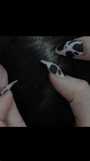 Asmr Scalp Check #asmr #scalpcheck #dandruff #nitpicking