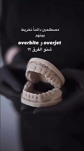 كيف تفرق بين overbite and overjet ...؟🦷✨️ #dental #dental_student #dentist #dentistry #طب_الأسنان