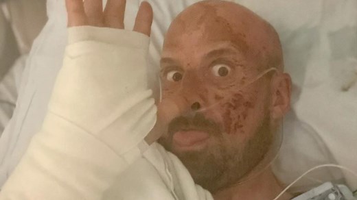 BGT' s Jonathan Goodwin paralysed and in a wheelchair after US stunt went wrong