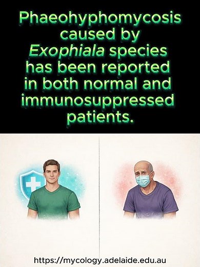 Mycology A-Z: Exophiala