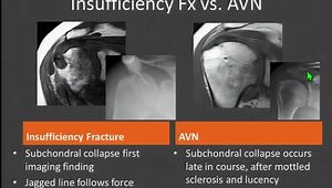 So You Thought You Knew Shoulder MRI?