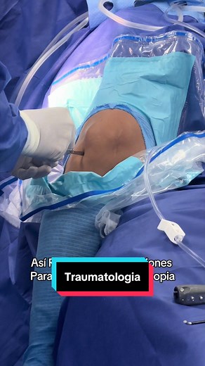 Artroscopia: Reparación de Lesiones de Ligamento