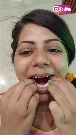 How to Wear & Remove Retainers; Dr. Srishti Bhatia
