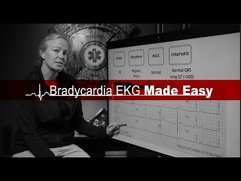Bradycardia EKG Made Easy