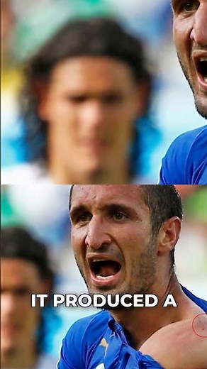 World Cup Shocker! Suarez's Unbelievable Bite!