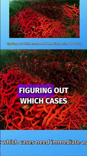 Understanding Clinically Significant Prostate Cancer #shorts