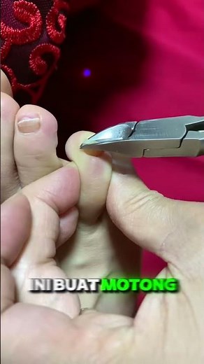 Kuku Jempol Cantengan? Coba Alat Ini Sekali Potong Langsung Lega