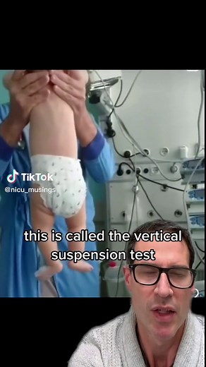 Two tests of #baby muscle tone. If your baby does this please see a #doctor‼️ ##doctorsoftiktok #medtok #neurology #pregnancy #pregnant #newborn