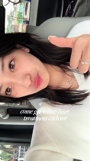 first time trying yellow laser 🥳 #rekomendasizap