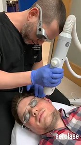 Celebrity Dermatologist Dr. Jason Emer performs the Era Erbium Laser by Aerolase to resurface (ablate) his patient's skin. This device allows a practitioner to precisely target all types of scars, including acne scars: ice pick, boxcar, rolling, deeper wrinkles and sun damage while building collagen long term. With an erbium laser treatment, there is 3 - 4 days of peeling and downtime. Numbing may be needed and recommended by your practitioner. Dr. Emer also explains the difference between an er