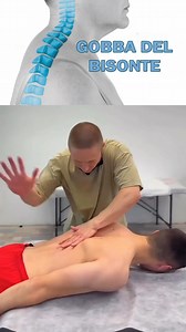 Addio ""gobba del bisonte"": l'esercizio che trasforma la tua postura in 3 semplici movimenti👇 La ""gobba del bisonte"" (o cifosi posturale) non è solo un problema estetico - è un segnale che il tuo corpo sta subendo uno stress costante che può portare a dolori cronici e problemi di mobilità. Questo esercizio mirato agisce direttamente sulla causa: ⚡ Rilascia la tensione accumulata nella zona toracica superiore ⚡ Riattiva i muscoli dorsali indeboliti dall'uso costante di smartphone e computer ⚡