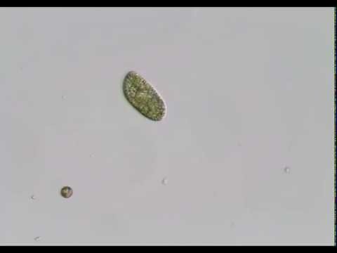 Under the microscope: a ciliate
