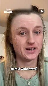 My TSW Journey: The Truth About Topical Steroid Withdrawal