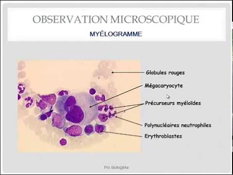 Coloration May Grunwald Giemsa ou MGG : باللغة العربية الدارجة