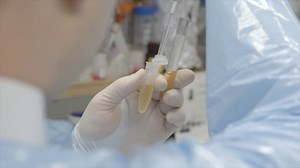 Stem Cell Treatments: Buyers Beware!