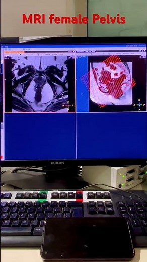 MRI female pelvis #mri #anatomy #medical #radiology #education #xray #doctor