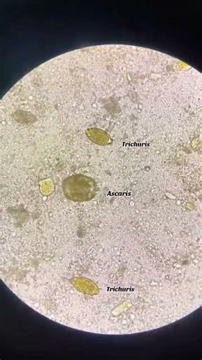microscope examination #learning