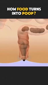 HOW FOOD TURNS INTO POOP #viralreels #trending #instagood #instagram #trendingreels #reels #medicalinsight #facebook #viral #food #poop #howfoodturntopoop | Gaurav Singh