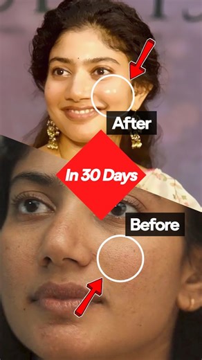 Ragav Barani | Skincare, Haircare & Lifestyle on Instagram: "Comment Tip to get this home remedy directly to your DM. These 3 home remedies are one of the best that I have ever tried and tested. I highly recommend you to apply if you have open pores. It is also best to use Niacinamide serum for better improvements. Use it twice a week. Skincare, home remedy, open pores home remedy, open pores solution, niacinamide, tamil skincare."