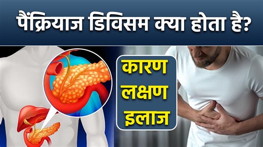 Pancreas Divisum Kya Hota Hai, Causes, Symptoms & Treatment In Hindi...|Boldsky Pancreas Divisum: शरीर में ब्लड शुगर को नियंत्रित करने के लिए इंसुलिन की आवश्यकता होती है और यह इंसुलिन पैंक्रियाज में बनती है। ऐसे में पैक्रियाज के कार्य ठीक से न होने पर कई तरह की समस्याएं हो सकती हैं। आगे जानते हैं पैंक्रियाज डिविसम के कारण और लक्षण क्या होते हैं? #Pancreasdivisum #Pancreasdivisumcauses #Pancreasdivisumreason #Pancreasdivisumsymptoms #Pancreasdivisumtreatment #Pancreaspainreason #Pancreasmedard #s