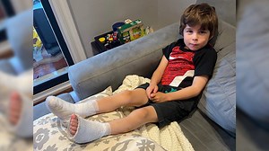 10K views · 87 reactions | The city is cracking down on illegal bonfires at Toronto Beaches after reports of people stepping on the hot coals and burning themselves since they aren't being extinguished properly. Ali Chiasson spoke to two mothers whose children both suffered burns from stepping on the coals. | CBC Toronto | Facebook