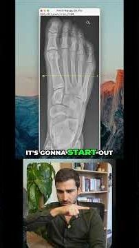 Plot/Line Profile of a Foot X-Ray (Part 1)