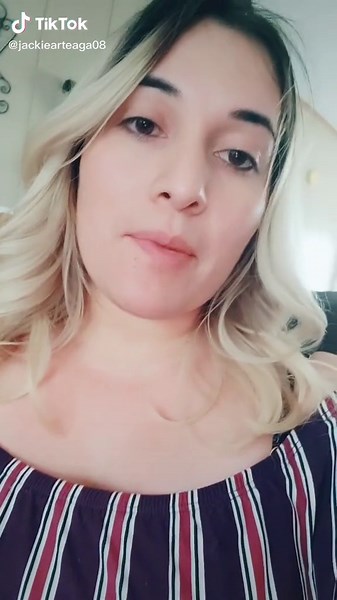 Mommy Makeover Surgery Update in Tijuana Mexico