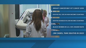 UnityPoint Health completes its 100th robotic lung procedure