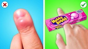 524K views · 4.9K reactions | Rich Doctor vs Poor Doctor || Awesome Parenting Hacks in Hospital! Funny Situations by Zoom Zoom | Zoom Zoom | Facebook