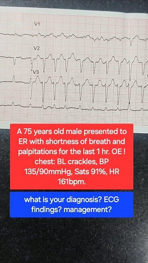 115K views · 284 reactions | Comment down your diagnosis and possible treatment in the commnet section⬇️ #cardiology #nursing #ekg #paramedic #nurse #emergency #ems #medicine #medstudent #cardiologist #ECG | The Stubborn Dr | Facebook