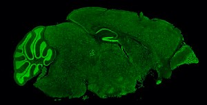 Potential Treatment for Fragile X Syndrome ID'ed | Genetics And Genomics