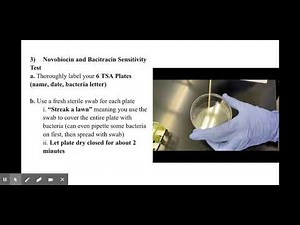 PROTOCOL 8: STAPHYLOCOCCUS AND STREPTOCOCCUS IDENTIFICATION - Google Slides