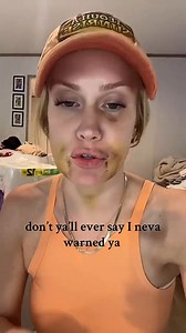 Wisdom tooth removal gone wrong! | Hello on FB