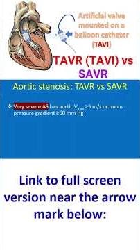 Aortic stenosis – TAVR (TAVI) vs SAVR