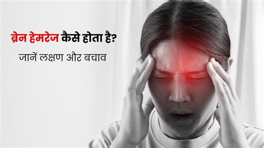 ब्रेन हेमरेज कैसे होता है? डॉक्टर से जानें इसके लक्षण और बचाव