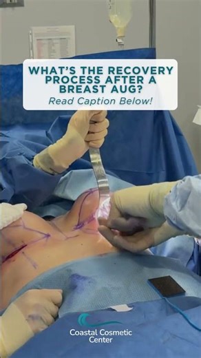 Breast augmentation recovery is typically smooth and predictable for most patients. ✨