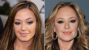 Side-by-side pics of Leah Remini don't help plastic surgery gossip