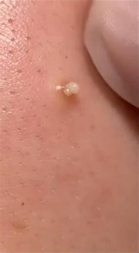 Unbelievable Skin Cleaning Macro