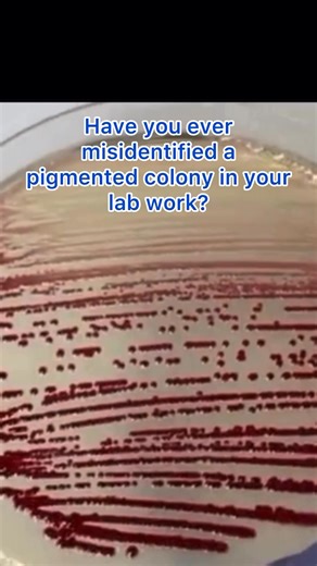 Bright red colonies on agar — contamination or a diagnostic clue? 🔬 Serratia marcescens can produce prodigiosin, a temperature-dependent pigment that may disappear at incubation temperatures. A strong reminder: never identify bacteria by color alone. Always confirm. #MedicalLaboratoryScience #ClinicalMicrobiology #LaboratoryMedicine #Microbiology #BiomedicalScience | Health knowledge explorer