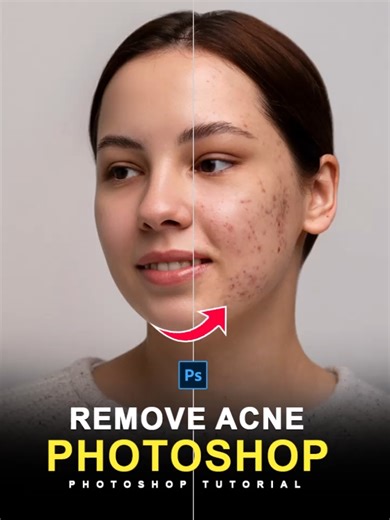 Gemini Tips – Remove Acne & Pimples From Face with Nano Banana