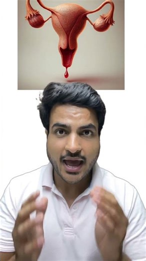 Abnormal Uterine Bleeding🩸 #mbbs #medicaleducation #obgyn #medicalstudents #mbbsbaba #gynecology