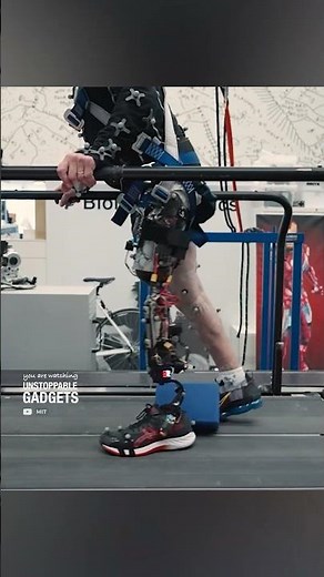 This prosthesis connects directly to the bone
