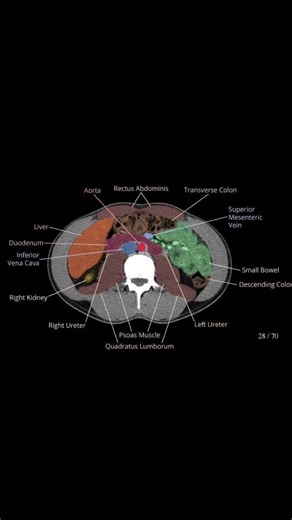 Understanding CT Abdomen Anatomy: Accurate Diagnosis