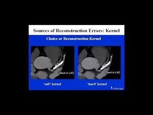 CCTA Training Lecture 5A CT Image Reconstruction