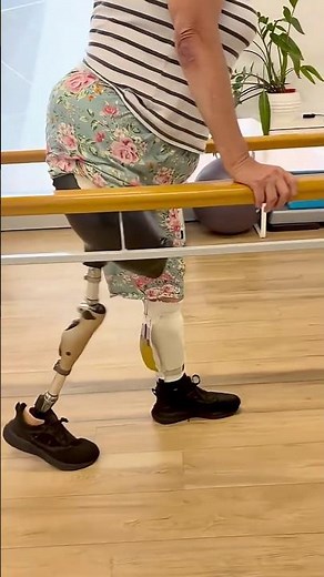 From Workshop to First Steps – A Custom Prosthetic Leg Story”* #prosthetics #legprosthesis